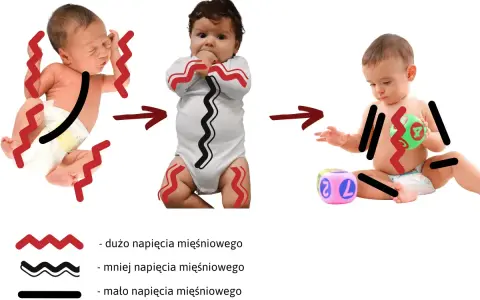 Trzy etapy rozwoju niemowlęcia: od wzmożonego napięcia mięśniowego, przez mniejsze, aż do swobodnych ruchów.